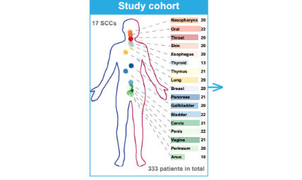 蛋白質(zhì)組學(xué)分析揭示多組織中鱗狀細胞癌和腺癌的關(guān)鍵區(qū)別