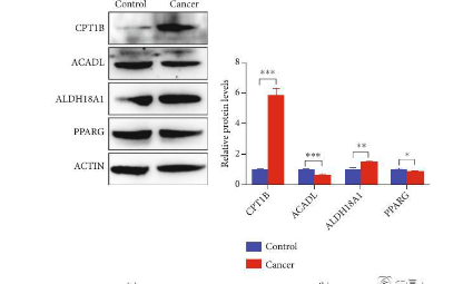 肺癌線粒體能量代謝途徑相關基因改變的綜合分析及其臨床意義