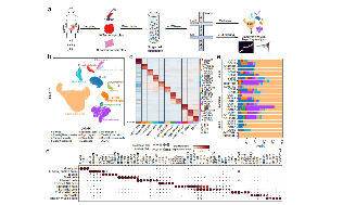 Nature communications--單細胞全面刻畫胃癌微環境