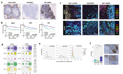 NC | 免疫分型之空間免疫表型