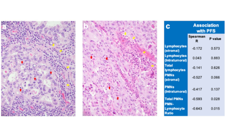 使用小鼠模型探究阿來替尼的反應機制