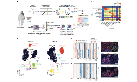 整合空間轉(zhuǎn)錄組和單細(xì)胞測序揭示PDAC組織結(jié)構(gòu)