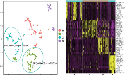 公共數(shù)據(jù)挖掘鑒定食管癌的潛在標志物