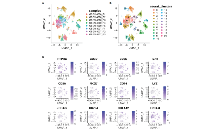 卵巢癌scRNA-seq和bulk RNA-seq結(jié)合分析