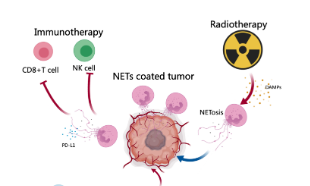 生信新熱點(diǎn)：中性粒細(xì)胞胞外誘捕網(wǎng)（NETs）