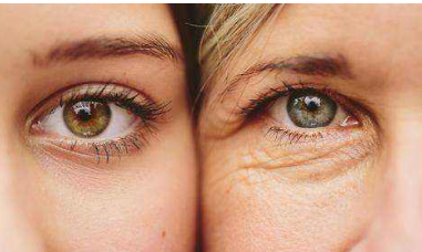 “利用衰老治療腫瘤”給了我們哪些金點子？