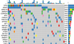 膽道癌基因組特征差異發13+SCI