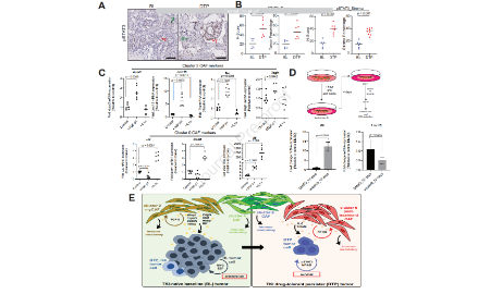 肺腺癌中DTP細(xì)胞與腫瘤復(fù)發(fā)