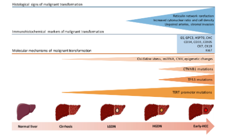 SXR202206006C “肝臟中的癌前病變”-不蹭熱點，關注臨床問題（萬字綜述解讀）
