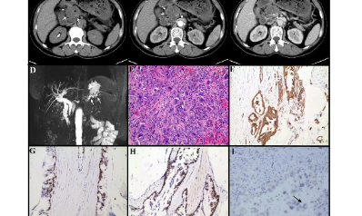 只有四個樣的單細胞分析怎么就沖到40+了呢？